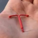 Pemasangan KB IUD dan Fakta Penting yang Harus Diketahui Pasien